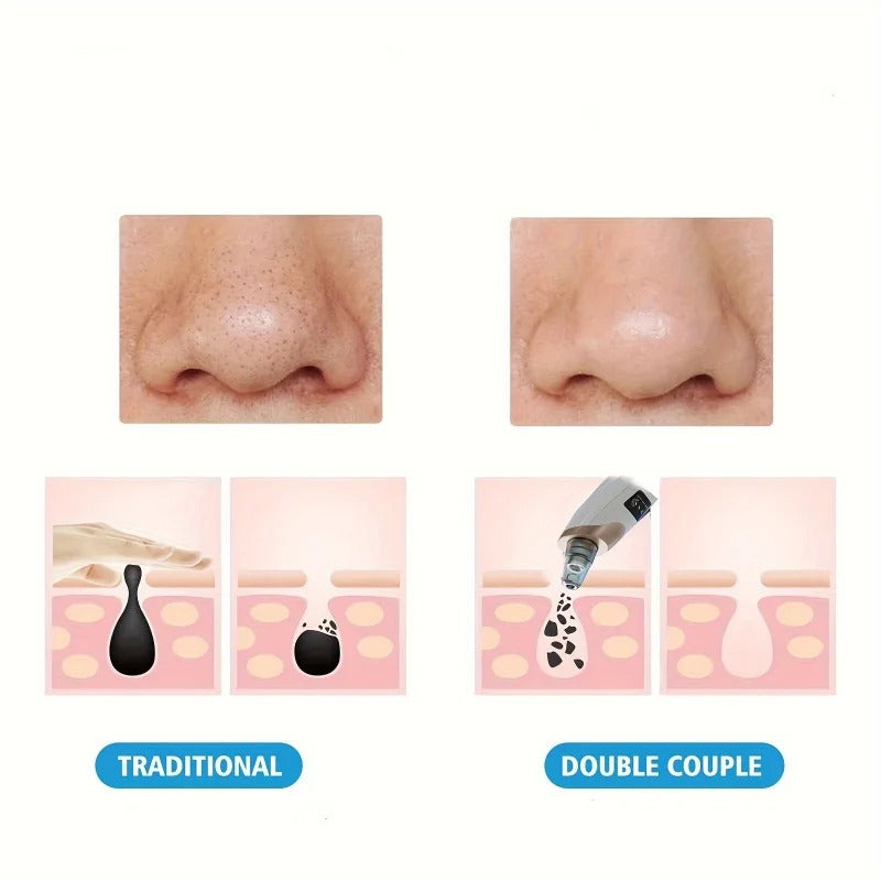 Rechargeable 5-in-1 Multifunctional Blackhead Remover & Pore Vacuum Cleaner